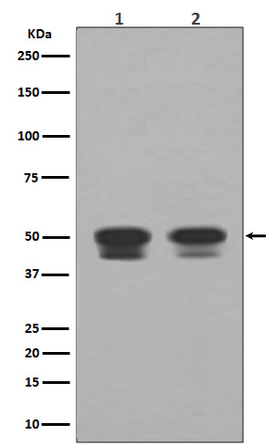 p53 Rabbit mAb