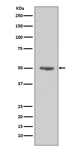 Cyclin E1 Rabbit mAb