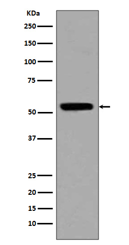 p53 (acetyl K370) Rabbit mAb