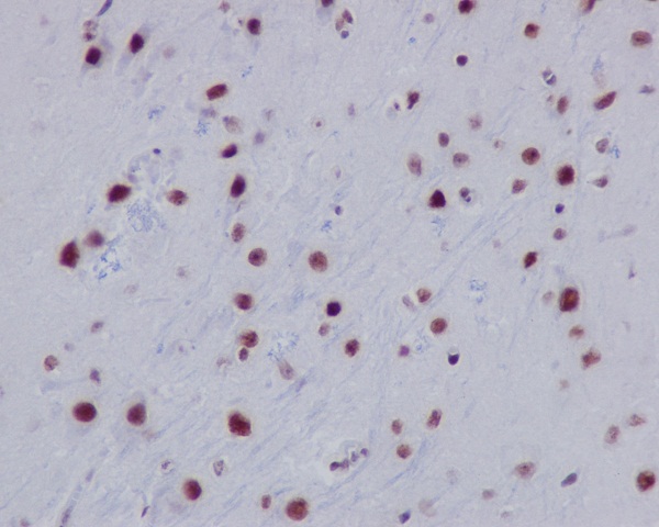 Histone H2A (acetyl K9) Rabbit mAb