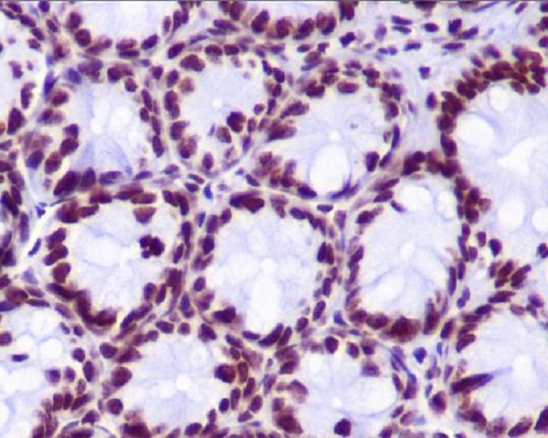 Histone H2A (hydroxyl Y39) Rabbit mAb