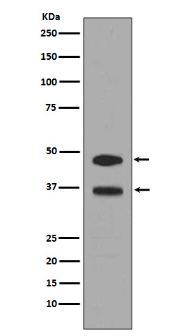 Fos B Rabbit mAb