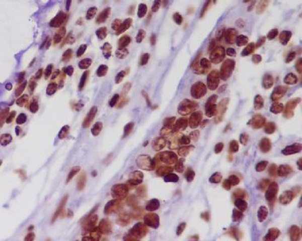 Histone H2A Rabbit mAb