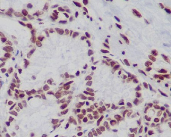 Histone H3 (mono+di+tri methyl K79) Rabbit mAb