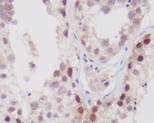 NUP98 Rabbit mAb