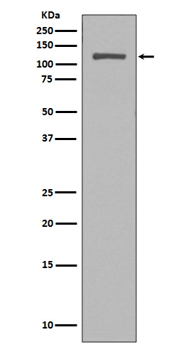 NUP98 Rabbit mAb