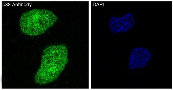 p38 MAPK Rabbit mAb