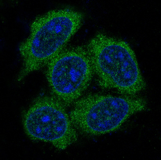 Hsp70 Rabbit mAb  