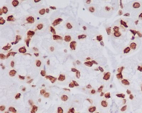 Histone H4 (tri methyl K20) Rabbit mAb