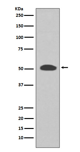 PI 3 Kinase p55 gamma Rabbit mAb