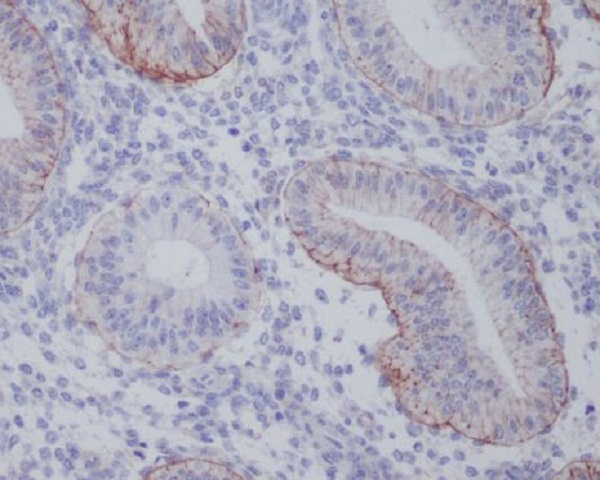 Integrin alpha 6 Rabbit mAb