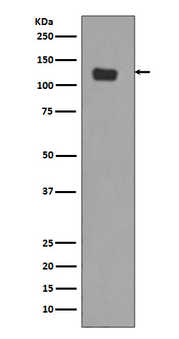 Integrin alpha 6 Rabbit mAb