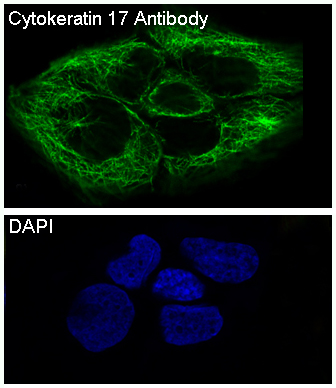 Cytokeratin 17 Rabbit mAb