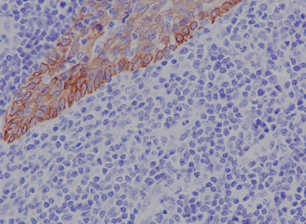 Cytokeratin 17 Rabbit mAb