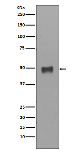 Cytokeratin 17 Rabbit mAb