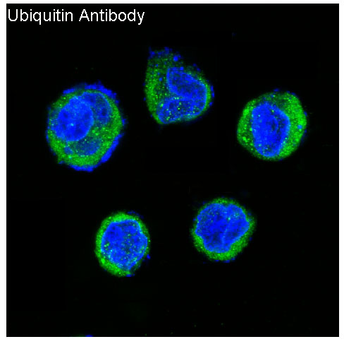 Ubiquitin Rabbit mAb