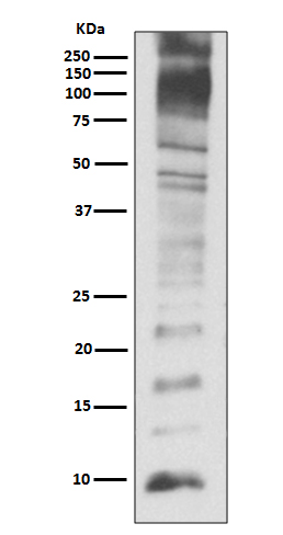 Ubiquitin Rabbit mAb