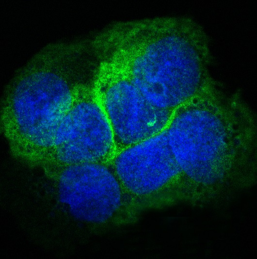 Collagen XVII Rabbit mAb