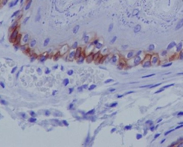 Collagen XVII Rabbit mAb