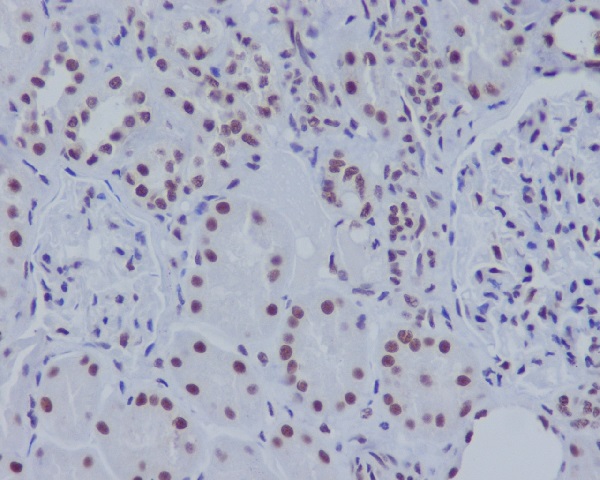 ASH2L Rabbit mAb