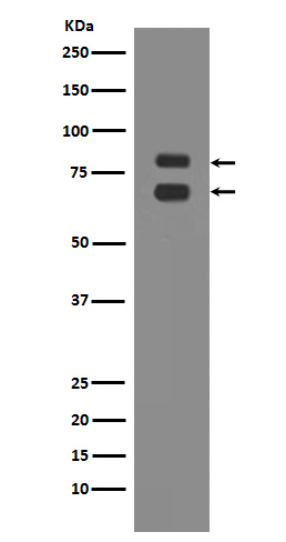 ASH2L Rabbit mAb