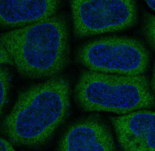 MAP1LC3A Rabbit mAb