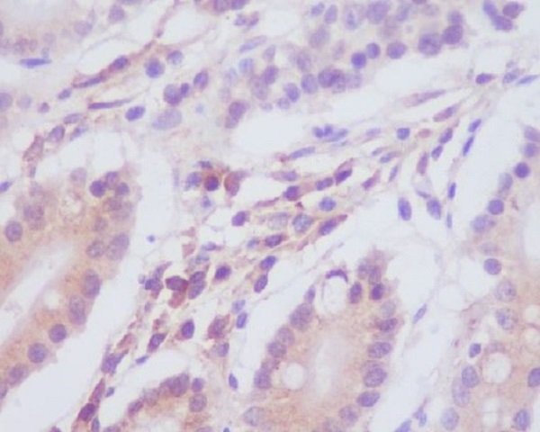 MAP1LC3A Rabbit mAb