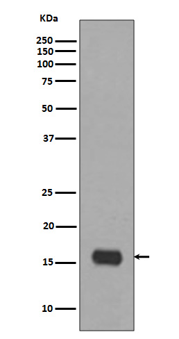 MAP1LC3A Rabbit mAb