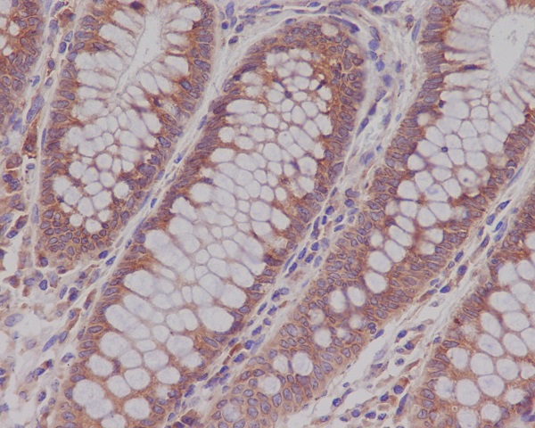 Rab5 Rabbit mAb