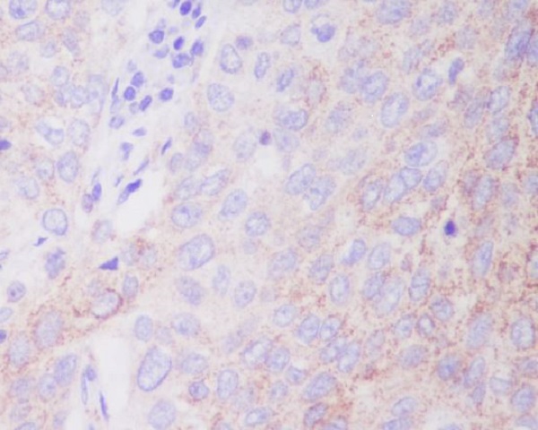 Hexokinase 1 Rabbit mAb