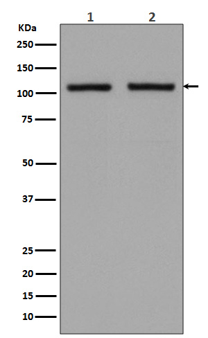 Hexokinase 1 Rabbit mAb