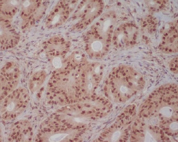 PI 3 Kinase p85 beta Rabbit mAb