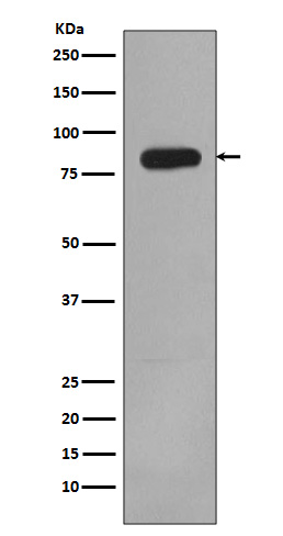 PI 3 Kinase p85 beta Rabbit mAb