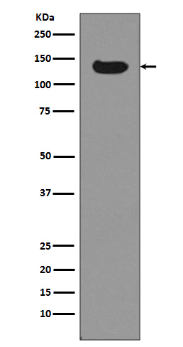 Dnmt3a Rabbit mAb