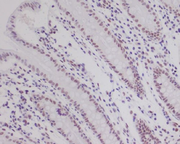 HIF-1 beta Rabbit mAb 