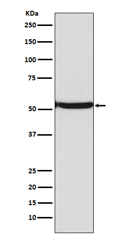 p53 (acetyl K382) Rabbit mAb