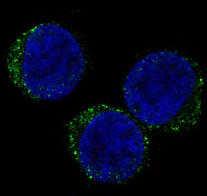 CD8 Rabbit mAb