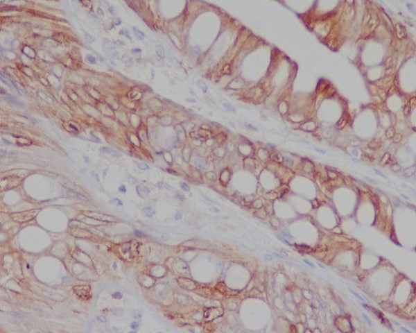 CD8 Rabbit mAb