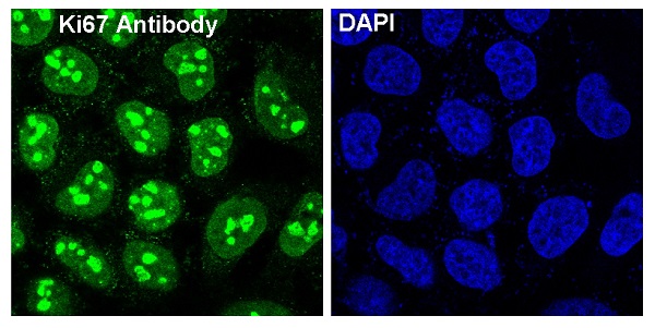 Ki67 Rabbit mAb 