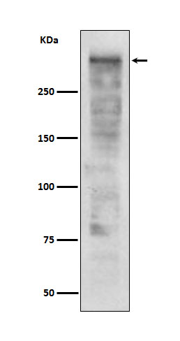 Ki67 Rabbit mAb 