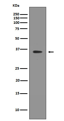 SIRT2 Rabbit mAb 