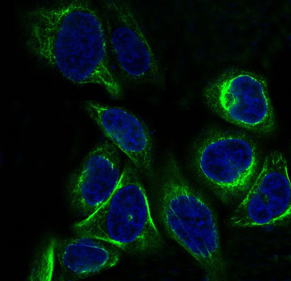 Cytokeratin 7 Rabbit mAb  