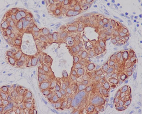 Cytokeratin 7 Rabbit mAb  