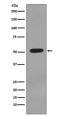 Cytokeratin 7 Rabbit mAb  