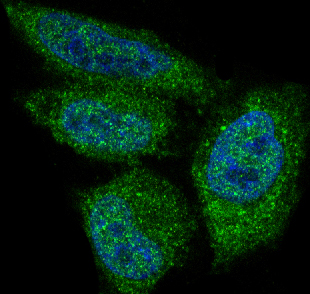 AKT1 Rabbit mAb