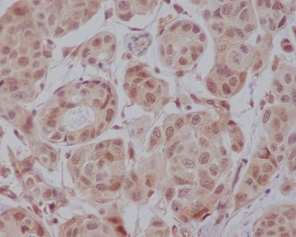 AKT1 Rabbit mAb