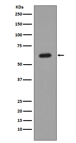 AKT1 Rabbit mAb