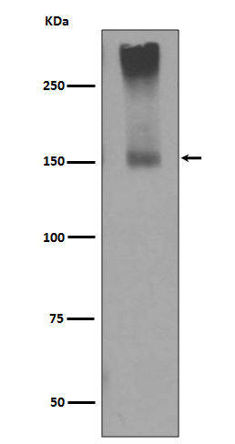 GRM5 Rabbit mAb  