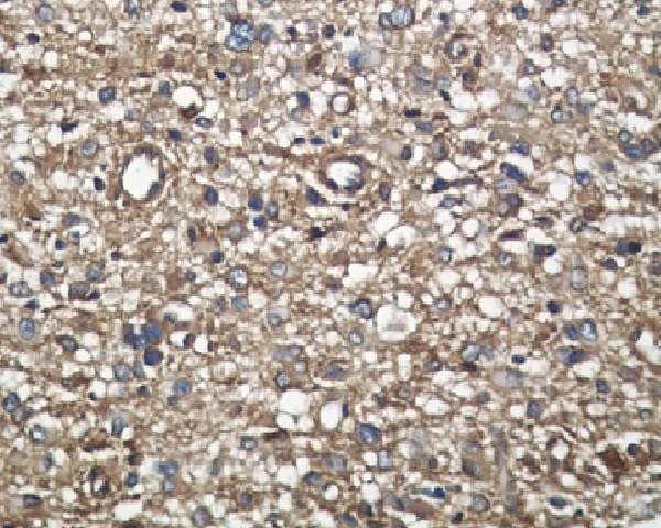 Midkine Rabbit mAb 