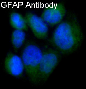 GFAP Rabbit mAb 